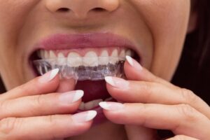 Is Invisalign The Right Option For You?